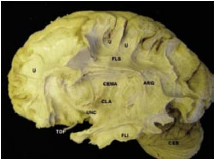 Estudo anatômico da substância branca do cérebro